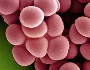 Budding cells of Saccharomyces cerevisiae, a species of yeast