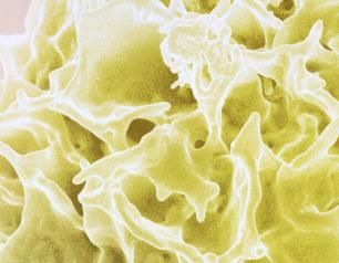 Natural Killer (NK) cell, a type of lymphocyte (white blood cell) that plays a crucial role in the immune system
