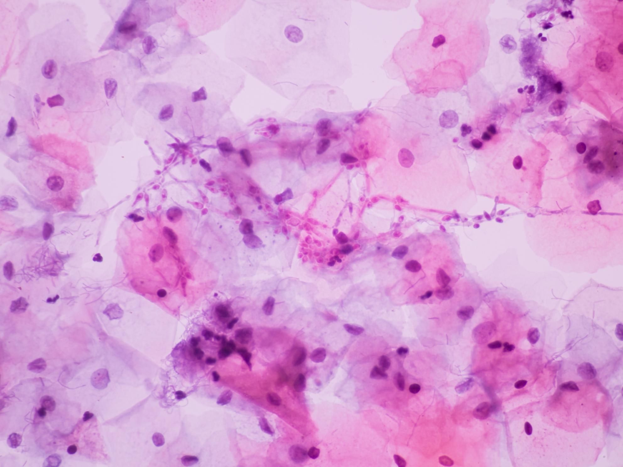 Microscopic view of Candidiasis cells
