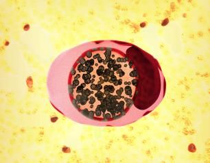 Chlamydia trachomatis, the bacterium responsible for Chlamydia