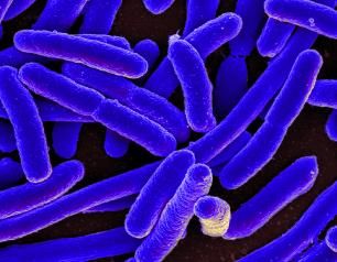 Microscopic view of Escherichia coli (E. coli)