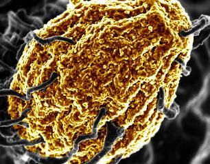 Scanning electron micrograph (SEM) showing a white blood cell (a phagocyte) engulfing a yeast particle