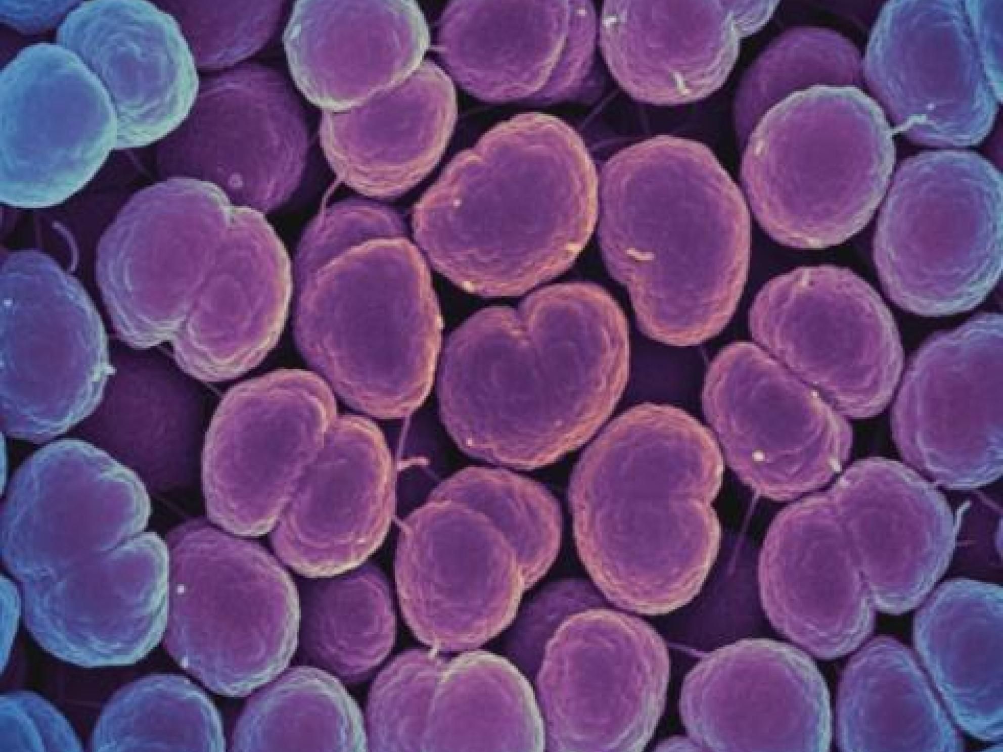 Scanned electron micrograph of the bacteria Neisseria gonorrhoeae, one of many bacteria which can cause Pelvic Inflammatory Disease