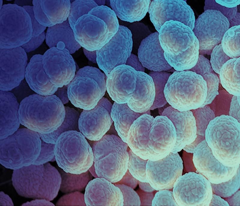 Scanning electron micrograph of Neisseria gonorrhoeae bacteria, which causes gonorrhea