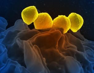 Scanning electron micrograph of Streptococcus pyogenes bacteria, also known as Group A Streptococcus (GAS)