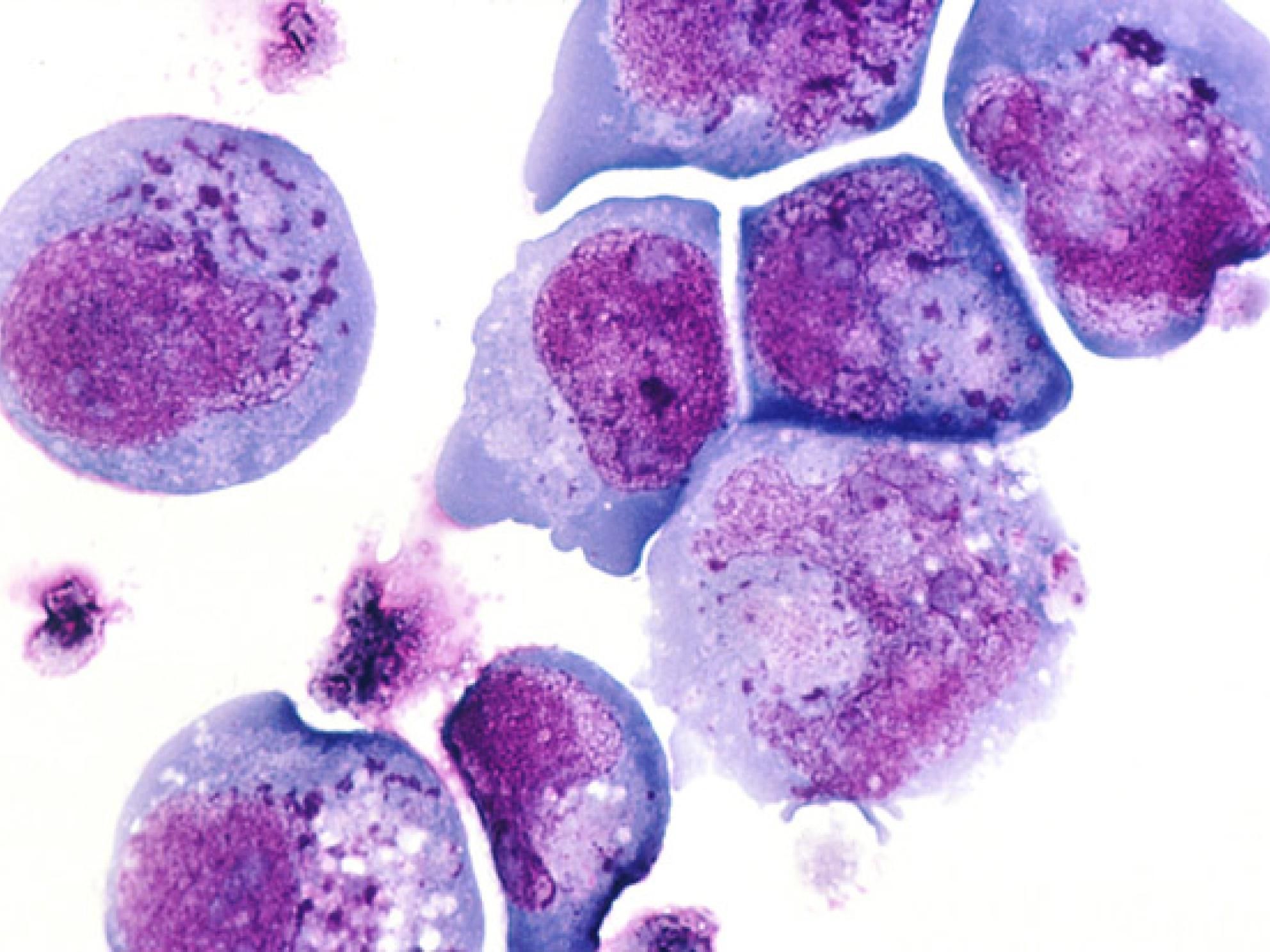 Photomicrograph of white blood cells infected with herpes virus