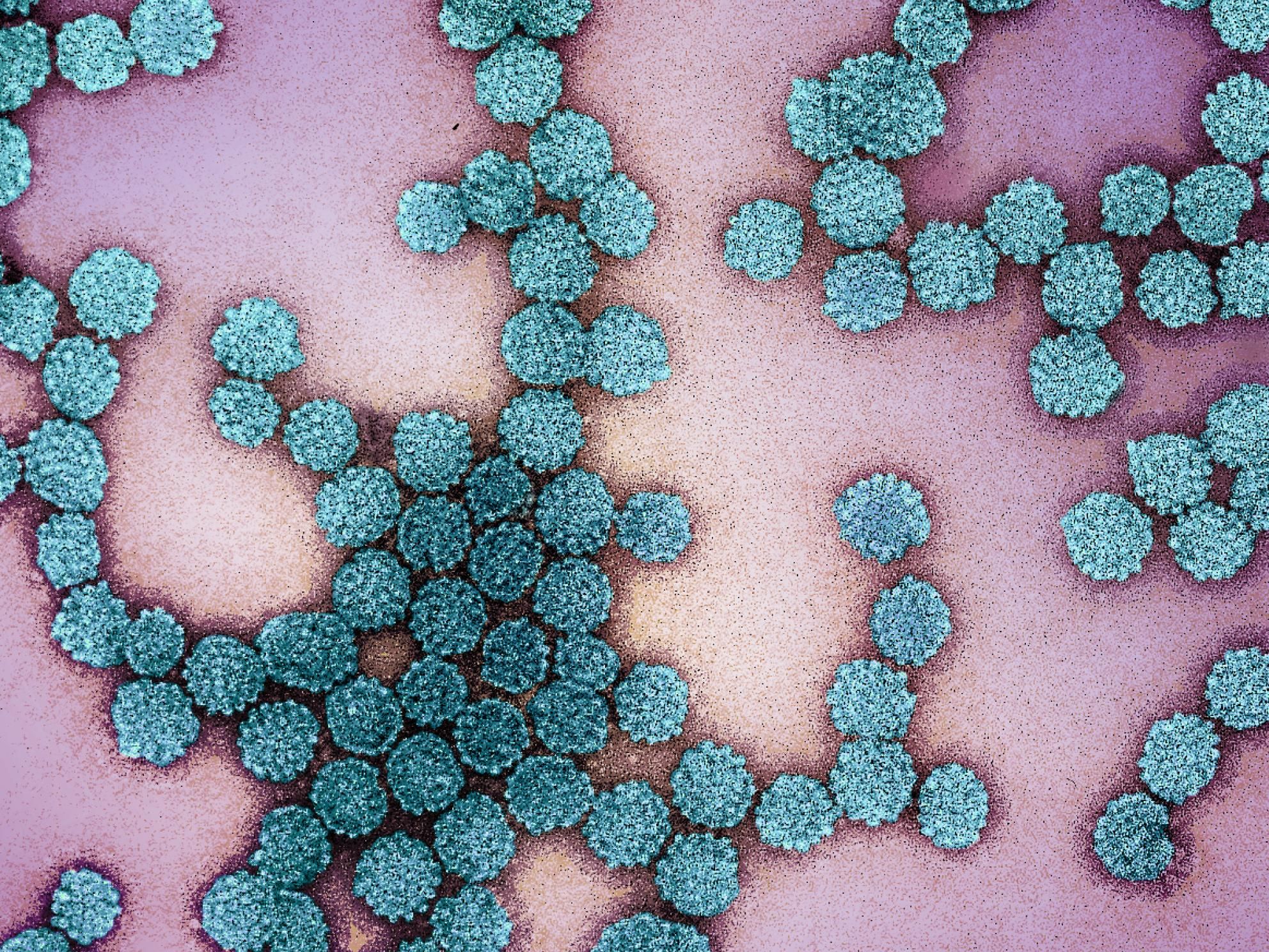 Colorized electron micrograph of human papillomavirus particles
