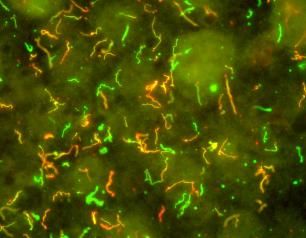 Micrograph of the bacteria that cause Lyme disease