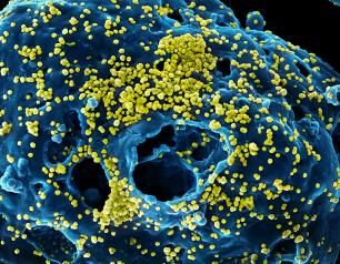 Microscopic view of Middle East Respiratory Syndrome (MERS) virus particles