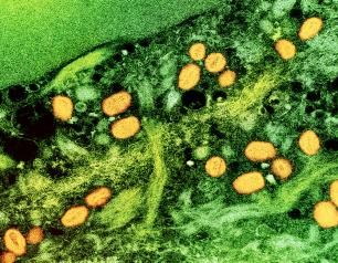 Electron micrograph of Mpox (monkeypox) virus particles found within an infected cell