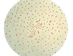 Micrograph showing the bacteria Bordetella pertussi