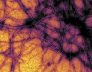 Prion protein aggregates in brain tissue