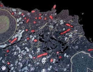 Colorized electron micrograph showing the bacterium Rickettsia rickettsii, the cause of Rocky Mountain spotted fever, inside a host cell