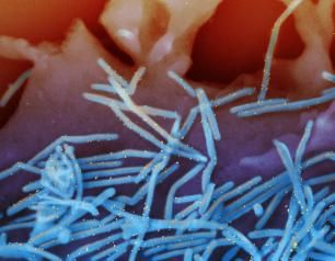 Colorized scanning electron micrograph of human respiratory syncytial virus (RSV) virions and labeled with anti-RSV F protein/gold antibodies shedding from the surface of human lung epithelial cells