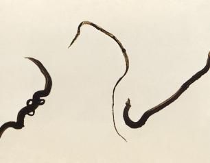 Schistosoma mansoni worms, a species of parasitic blood fluke that causes Schistosomiasis