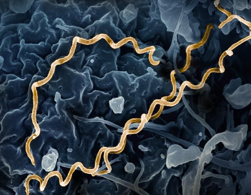 Colorized electron micrograph of Treponema pallidum, the bacteria that cause syphilis
