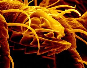 Scanning electron micrograph of a tick