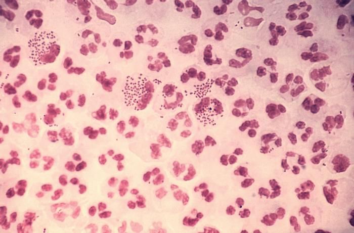 Photomicrograph of a Gram-stained urethral smear specimen