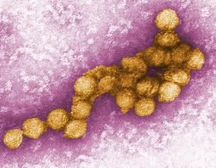 Transmission electron micrograph of West Nile Virus