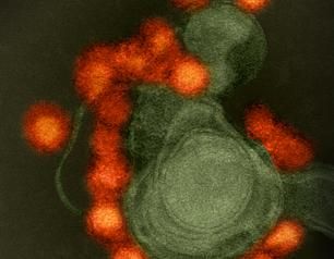 Electron microscope image of Zika virus particles